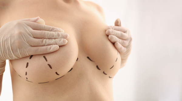 LESSONS I LEARNED: WHAT YOU NEED TO KNOW BEFORE YOUR BREAST AUGMENTATION