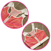 Surgical Support Bra - Red Stripe